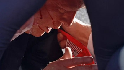 特朗普称右耳上部中枪，美警方称其被提词器碎片击中