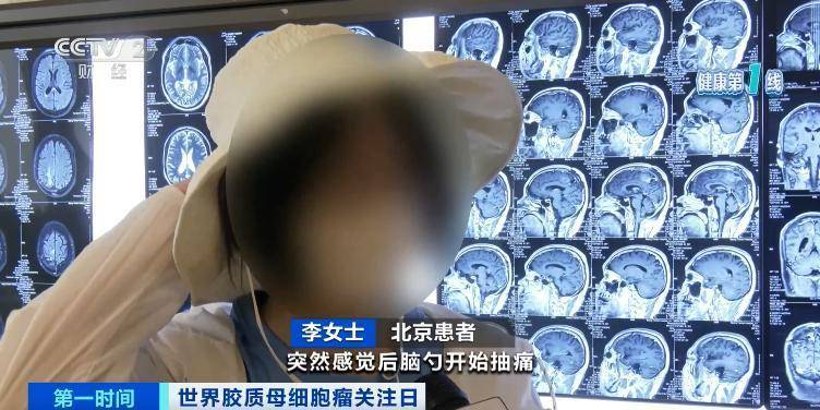 五年存活率仅有10%！突发恶心、头疼，警惕