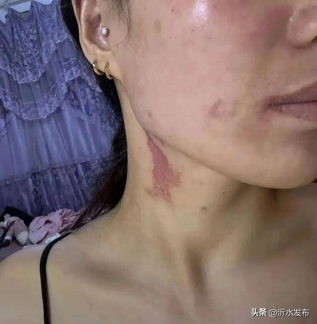 山东多地现这种虫子，千万别拍！