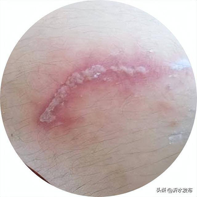 山东多地现这种虫子，千万别拍！