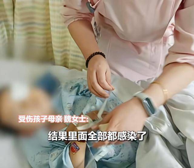 江西一5岁男孩在幼儿园被戳伤致左眼失明，家长称老师用猪油涂抹试图消肿