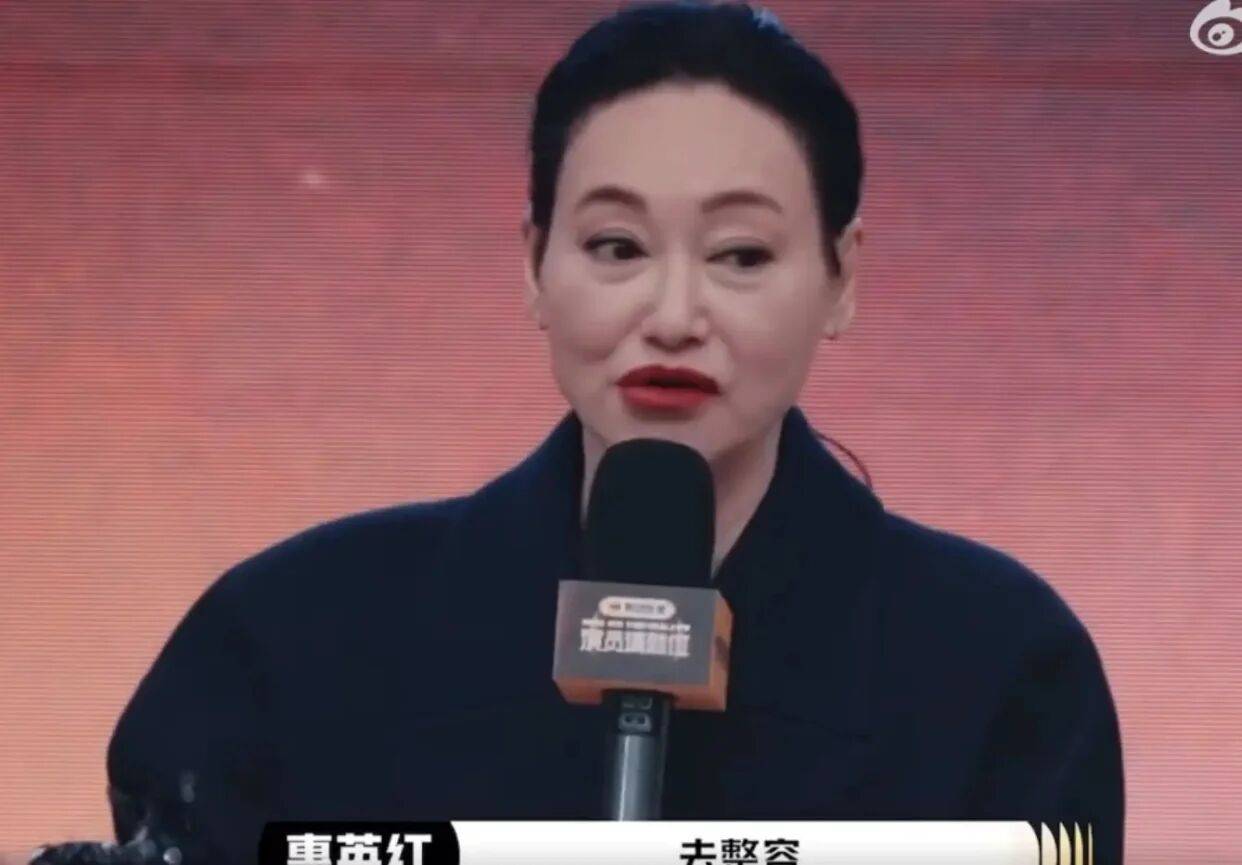 考古|惠英红自曝拿奖后谈百倍涨薪！拍打戏至残疾阑尾手术后7天复工，她的人生是拼出来的