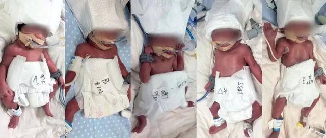 新疆一24岁产妇凌晨生下5胞胎(1男4女),最重1030克,最轻仅870克,概率六千万分之一